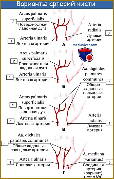 Варіанти артерій долоні зображення